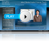Dental Implants Presentation